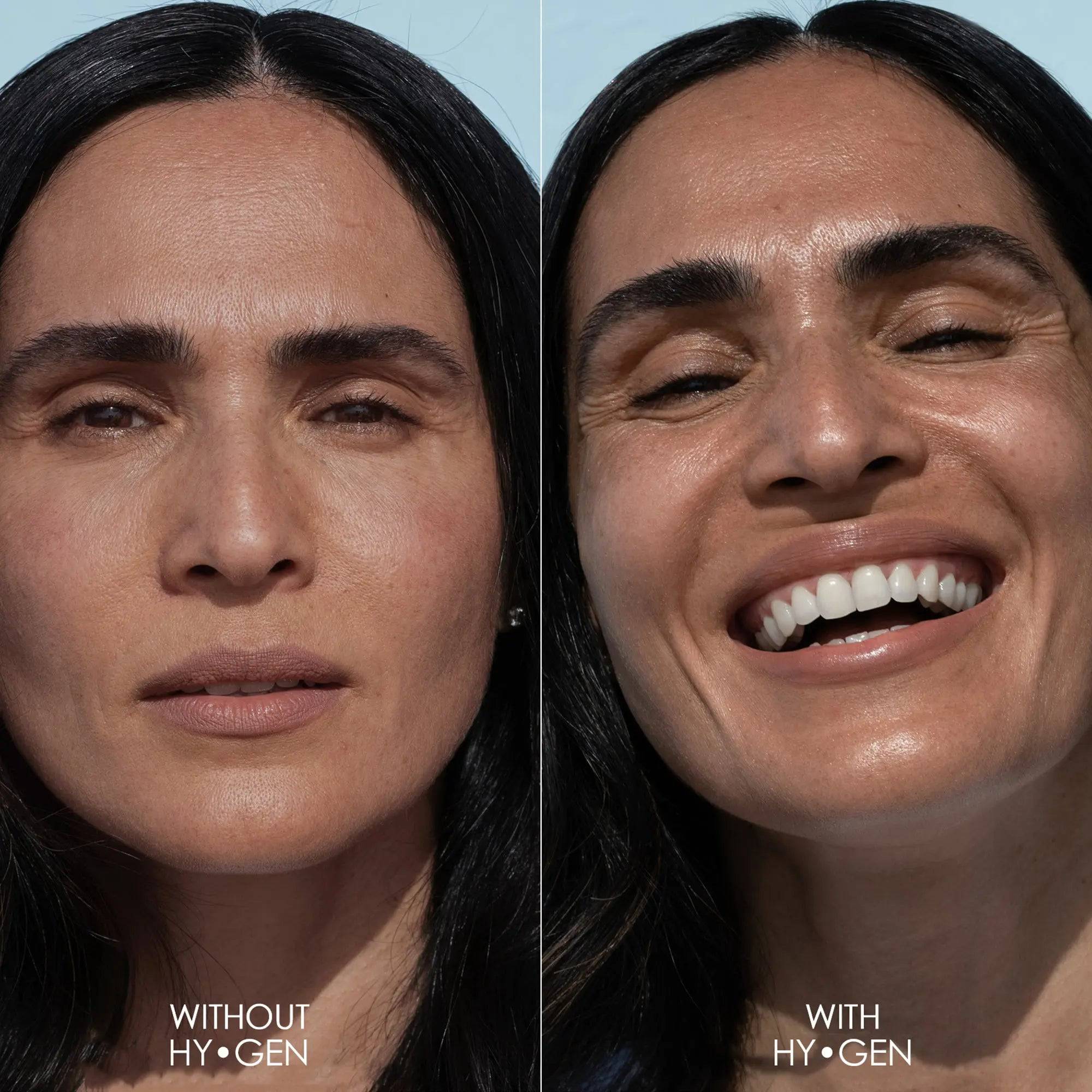 HY-GEN PRIMER SERUM - Image 3