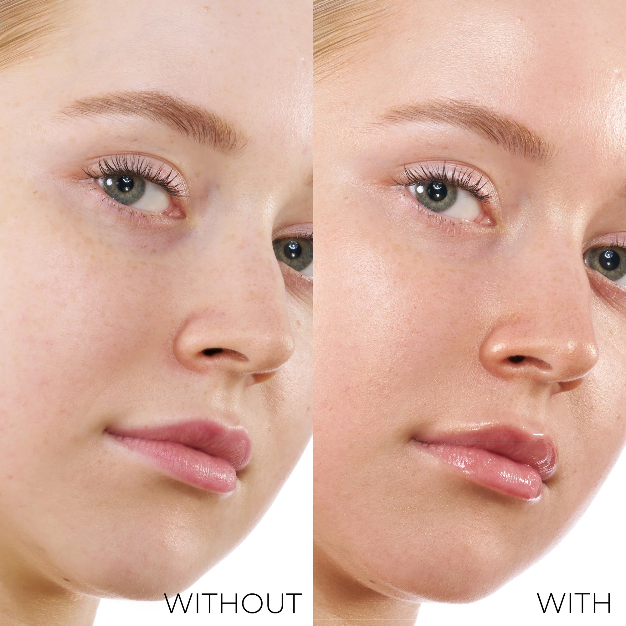 HY-GEN BRONZE - Image 4